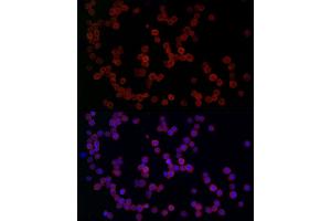 Immunofluorescence analysis of THP-1 cells using YKL-40/CHI3L1 Rabbit pAb (ABIN1679214, ABIN1679215, ABIN1679216, ABIN5664234 and ABIN6220124) at dilution of 1:50 (40x lens). (CHI3L1 抗体  (AA 22-240))