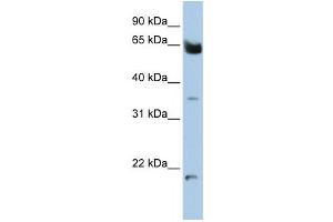 Western Blotting (WB) image for anti-Homeobox and Leucine Zipper Encoding (HOMEZ) antibody (ABIN2459136) (HOMEZ 抗体)