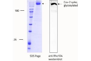 Western Blotting (WB) image for SARS-CoV-2 Spike (Trimer) protein (rho-1D4 tag) (ABIN6952670)