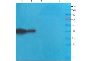 Western Blot using anti-CDCrel-1 antibody ABIN7072252 Rat brain (lane 1), mouse spinal cord (lane 2), rat testis (lane 3), human lung cancer (lane 4) and human breast cancer (lane 5) samples were resolved on a 12 % SDS PAGE gel and blots probed with ABIN7072252 at 2 μg/mL before being detected by a secondary antibody. (Recombinant Septin 5 抗体)