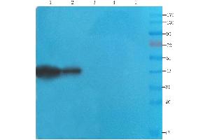 Western Blot using anti-CDCrel-1 antibody ABIN7072252 Rat brain (lane 1), mouse spinal cord (lane 2), rat testis (lane 3), human lung cancer (lane 4) and human breast cancer (lane 5) samples were resolved on a 12 % SDS PAGE gel and blots probed with ABIN7072252 at 2 μg/mL before being detected by a secondary antibody. (Recombinant Septin 5 抗体)