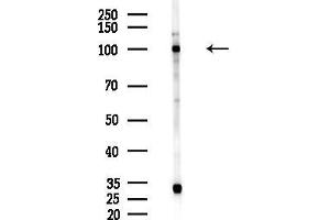 anti-Endothelin Converting Enzyme 2 (ECE2) (C-Term) antibody