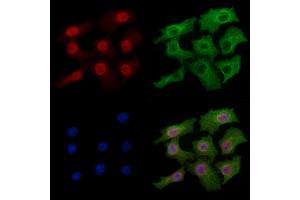Phospho-TOP2A (Thr1343) Antibody staining Hela cells(heat shock treatment) by IF/ICC. (Topoisomerase II alpha 抗体  (pThr1343))