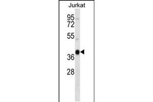 Western blot analysis in Jurkat cell line lysates (35ug/lane). (MARCH4 抗体  (C-Term))