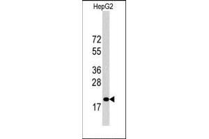 Image no. 2 for anti-Cyclin-Dependent Kinase Inhibitor 1B (p27, Kip1) (CDKN1B) (C-Term) antibody (ABIN358766) (CDKN1B 抗体  (C-Term))