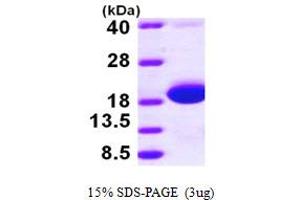 SDS-PAGE (SDS) image for SKP (AA 21-161) protein (His tag) (ABIN667019) (SKP (AA 21-161) protein (His tag))