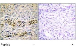 Immunohistochemistry analysis of paraffin-embedded human ovary tissue using AKT1 polyclonal antibody . (AKT1 抗体)