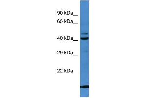 Western Blotting (WB) image for anti-serpin Peptidase Inhibitor, Clade B (Ovalbumin), Member 8 (SERPINB8) (N-Term) antibody (ABIN2774201) (SERPINB8 抗体  (N-Term))