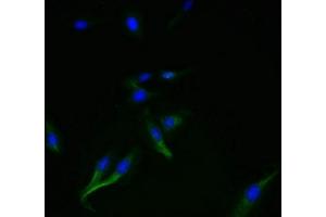Immunofluorescent analysis of Hela cells using ABIN7169852 at dilution of 1:100 and Alexa Fluor 488-congugated AffiniPure Goat Anti-Rabbit IgG(H+L) (SMIM14 抗体  (AA 1-49))