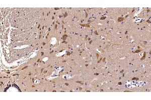 Detection of AST2 in Rat Spinal cord Tissue using Polyclonal Antibody to Aspartate Aminotransferase 2 (AST2) (AST2 (AA 30-430) 抗体)
