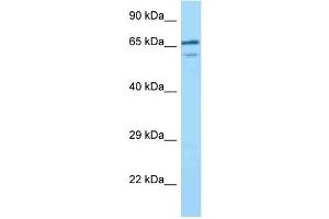 WB Suggested Anti-VILL Antibody Titration: 1. (VILL 抗体  (C-Term))