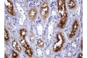 Image no. 1 for anti-ATP-Binding Cassette, Sub-Family B (MDR/TAP), Member 1 (ABCB1) (AA 347-710) antibody (ABIN1491433)