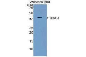 Western Blotting (WB) image for anti-Insulin Receptor (INSR) (AA 1027-1364) antibody (ABIN1859478) (Insulin Receptor 抗体  (AA 1027-1364))