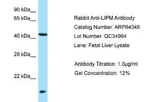 Western Blotting (WB) image for anti-Lipase, Family Member M (LIPM) (N-Term) antibody (ABIN2789813) (LIPM 抗体  (N-Term))