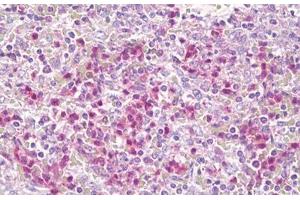 Anti-CSF2RB / CD131 antibody IHC staining of human spleen, neutrophils. (CD131 抗体  (AA 559-608))