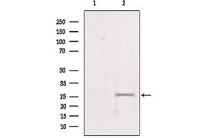 Western blot analysis of extracts from mouse brain, using LGALS3 Antibody. (Galectin 3 抗体  (Internal Region))