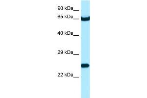 WB Suggested Anti-STXBP3 Antibody Titration: 1. (STXBP3 抗体  (C-Term))