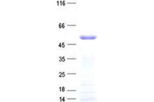 Western Blotting (WB) image for Zinc Finger Protein 19 (ZNF19) protein (His tag) (ABIN2735941)