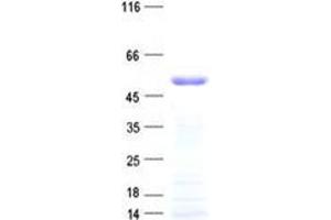 ZNF19 Protein (His tag)