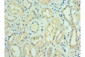 Immunohistochemistry of paraffin-embedded human kidney tissue using ABIN7143736 at dilution of 1:100 (FUT6 抗体  (AA 170-359))
