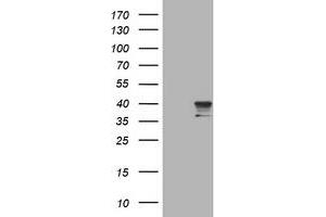 Image no. 1 for anti-Sialidase 1 (Lysosomal Sialidase) (NEU1) (AA 48-315) antibody (ABIN1491550) (NEU1 抗体  (AA 48-315))