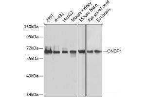 Western blot analysis of extracts of various cell lines using CNDP1 Polyclonal Antibody at dilution of 1:1000. (CNDP1 抗体)