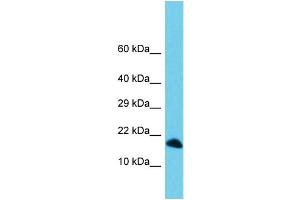 Host: Rabbit Target Name: C3orf36 Sample Type: 721_B Whole Cell lysates Antibody Dilution: 1. (C3ORF36 抗体  (C-Term))