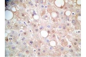 Human liver tissue was stained by Rabbit Anti-FGF-21 (26-47) (H) Antibody (FGF21 抗体  (AA 26-47))