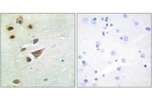 Immunohistochemistry analysis of paraffin-embedded human brain tissue, using NT5C3 Antibody. (NT5C3 抗体  (AA 11-60))