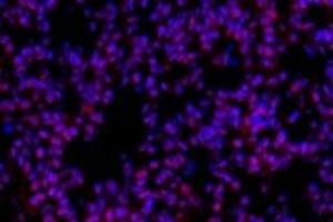 Immunofluorescent analysis of paraformaldehyde-fixed mouse lung usingp38IP (ABIN7075954) at dilution of 1: 400 (Transcription Factor SPT20 Homolog (SUPT20H) 抗体)