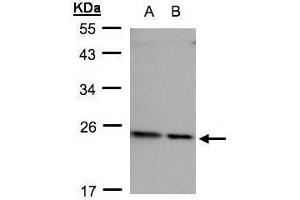 WB Image Sample(30 ug whole cell lysate) A: HeLa S3, B: Hep G2, 12% SDS PAGE diluted at 1:500 (RPL17 抗体)