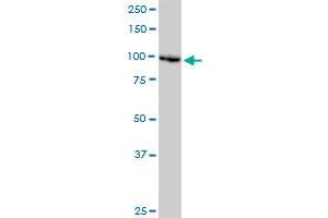 DDX11 monoclonal antibody (M03), clone 3C1. (DDX11 抗体  (AA 1-970))