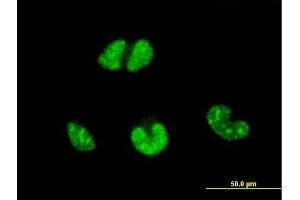 Immunofluorescence of monoclonal antibody to ESR2 on HeLa cell. (ESR2 抗体  (AA 22-121))