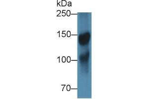 Western blot analysis of Pig Cerebrum lysate, using Rabbit Anti-Human ICAM5 Antibody (1 µg/ml) and HRP-conjugated Goat Anti-Rabbit antibody (abx400043, 0. (ICAM5 抗体  (AA 409-674))