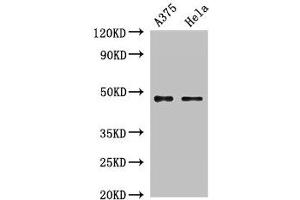 Western Blot Positive WB detected in: A375 whole cell lysate, Hela whole cell lysate All lanes: RPL4 antibody at 2 μg/mL Secondary Goat polyclonal to rabbit IgG at 1/50000 dilution Predicted band size: 48 kDa Observed band size: 48 kDa (RPL4 抗体  (AA 12-91))