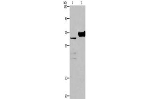 Western Blotting (WB) image for anti-Choline Dehydrogenase (CHDH) antibody (ABIN2423153) (CHDH 抗体)