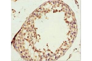 Immunohistochemistry of paraffin-embedded human testis tissue using ABIN7157773 at dilution of 1:100 (L2HGDH 抗体  (AA 1-220))