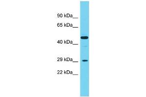 Host:  Rabbit  Target Name:  Cpa2  Sample Type:  Rat Spleen lysates  Antibody Dilution:  1. (Carboxypeptidase A2 抗体  (Middle Region))