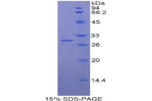 SDS-PAGE analysis of Human Myosin IG Protein. (MYO1G 蛋白)