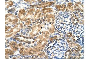 GCNT3 antibody was used for immunohistochemistry at a concentration of 4-8 ug/ml. (GCNT3 抗体)