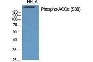 Western Blotting (WB) image for anti-Acetyl-CoA Carboxylase alpha (ACACA) (pSer80) antibody (ABIN3182481) (Acetyl-CoA Carboxylase alpha 抗体  (pSer80))