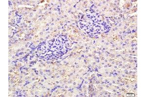 Paraformaldehyde-fixed, paraffin embedded rat kidney tissue, Antigen retrieval by boiling in sodium citrate buffer(pH6) for 15min, Block endogenous peroxidase by 3% hydrogen peroxide for 30 minutes, Blocking buffer (normal goat serum) at 37°C for 20min, Antibody incubation with Rabbit Anti-TLR3 Polyclonal Antibody, Unconjugated  at 1:400 overnight at 4°C, followed by a conjugated secondary and DAB staining (TLR3 抗体  (AA 801-905))
