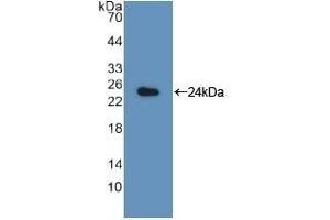 Western Blotting (WB) image for anti-Proteasome (Prosome, Macropain) Subunit, beta Type, 8 (Large Multifunctional Peptidase 7) (PSMB8) (AA 80-261) antibody (ABIN7440281)