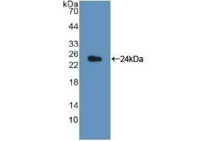 Detection of Recombinant LMP7, Rat using Polyclonal Antibody to Large Multifunctional Peptidase 7 (LMP7) (PSMB8 抗体  (AA 80-261))