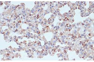 Immunohistochemistry of paraffin-embedded Rat lung using PDGFR beta Polyclonal Antibody at dilution of 1:100 (40x lens). (PDGFRB 抗体)