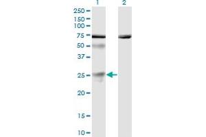 Western Blot analysis of TWSG1 expression in transfected 293T cell line by TWSG1 monoclonal antibody (M01), clone 6E6. (TWSG1 抗体  (AA 124-223))