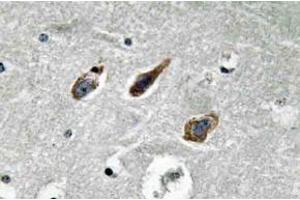 Immunohistochemistry (IHC) analyzes of Annexin II antibody in paraffin-embedded human brain tissue. (Annexin A2 抗体)