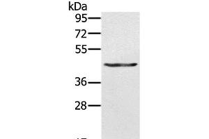 Western Blot analysis of A549 cell using KRT31 Polyclonal Antibody at dilution of 1:500 (Keratin 31 抗体)