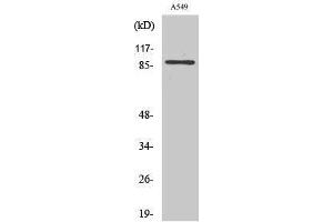 Western Blotting (WB) image for anti-Chloride Channel, Voltage-Sensitive 7 (CLCN7) (N-Term) antibody (ABIN3174436) (CLCN7 抗体  (N-Term))