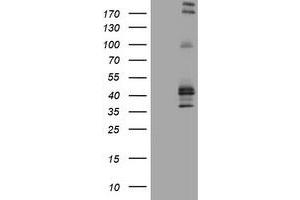 Image no. 2 for anti-Fc Fragment of IgE, Low Affinity II, Receptor For (CD23) (FCER2) (AA 48-321) antibody (ABIN1491554) (FCER2 抗体  (AA 48-321))